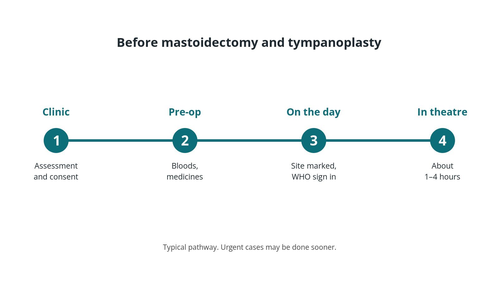 Timeline of the usual steps before mastoidectomy and tympanoplasty: Clinic: Assessment and consent, Pre-op: Bloods, medicines, On the day: Site marked, WHO sign in, In theatre: About 1–4 hours