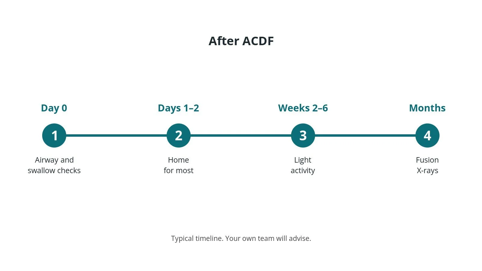 Recovery timeline after ACDF: Day 0: Airway and swallow checks, Days 1–2: Home for most, Weeks 2–6: Light activity, Months: Fusion X-rays