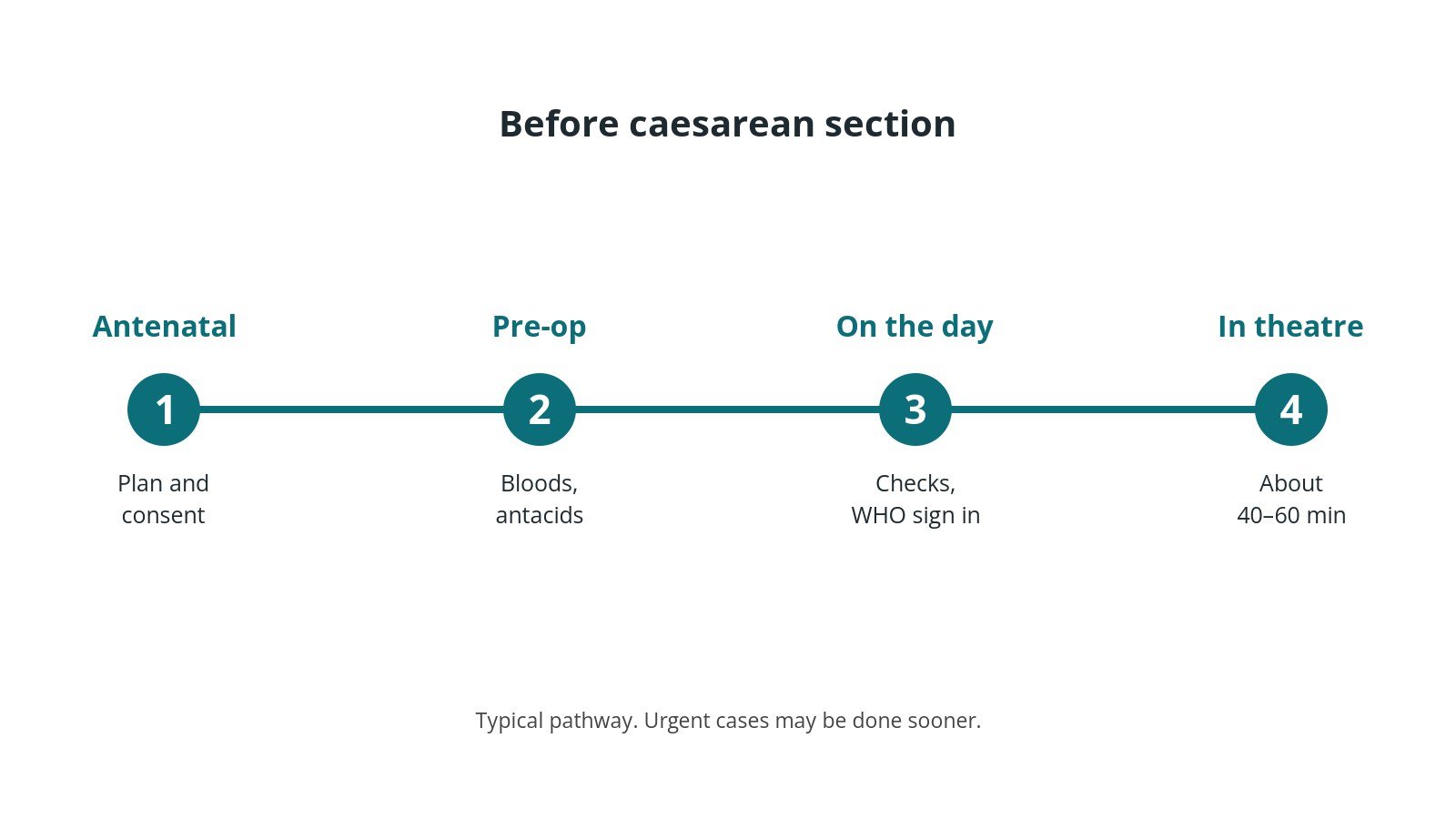 Timeline of the usual steps before caesarean section: Antenatal: Plan and consent, Pre-op: Bloods, antacids, On the day: Checks, WHO sign in, In theatre: About 40–60 min