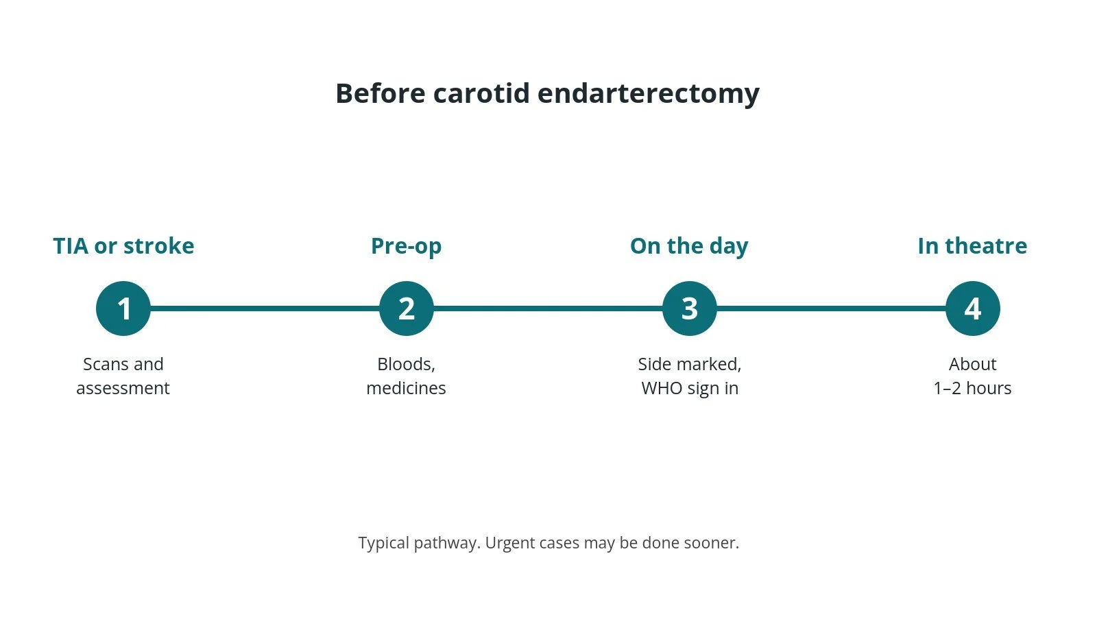 Timeline of the usual steps before carotid endarterectomy: TIA or stroke: Scans and assessment, Pre-op: Bloods, medicines, On the day: Side marked, WHO sign in, In theatre: About 1–2 hours