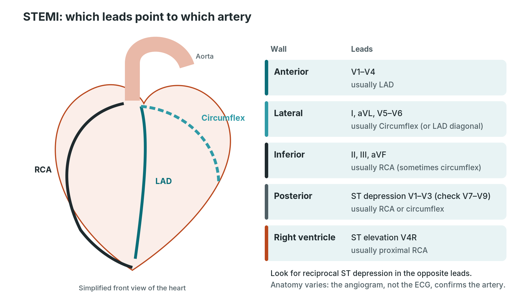 STEMI territory map linking ECG leads to the LAD, circumflex and right coronary artery