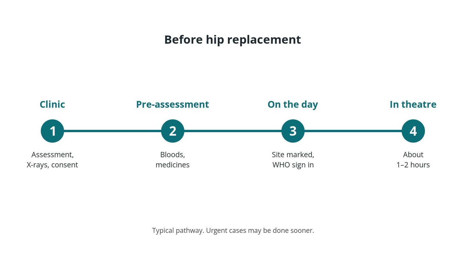 Timeline of the usual steps before hip replacement: Clinic: Assessment, X-rays, consent, Pre-assessment: Bloods, medicines, On the day: Site marked, WHO sign in, In theatre: About 1–2 hours