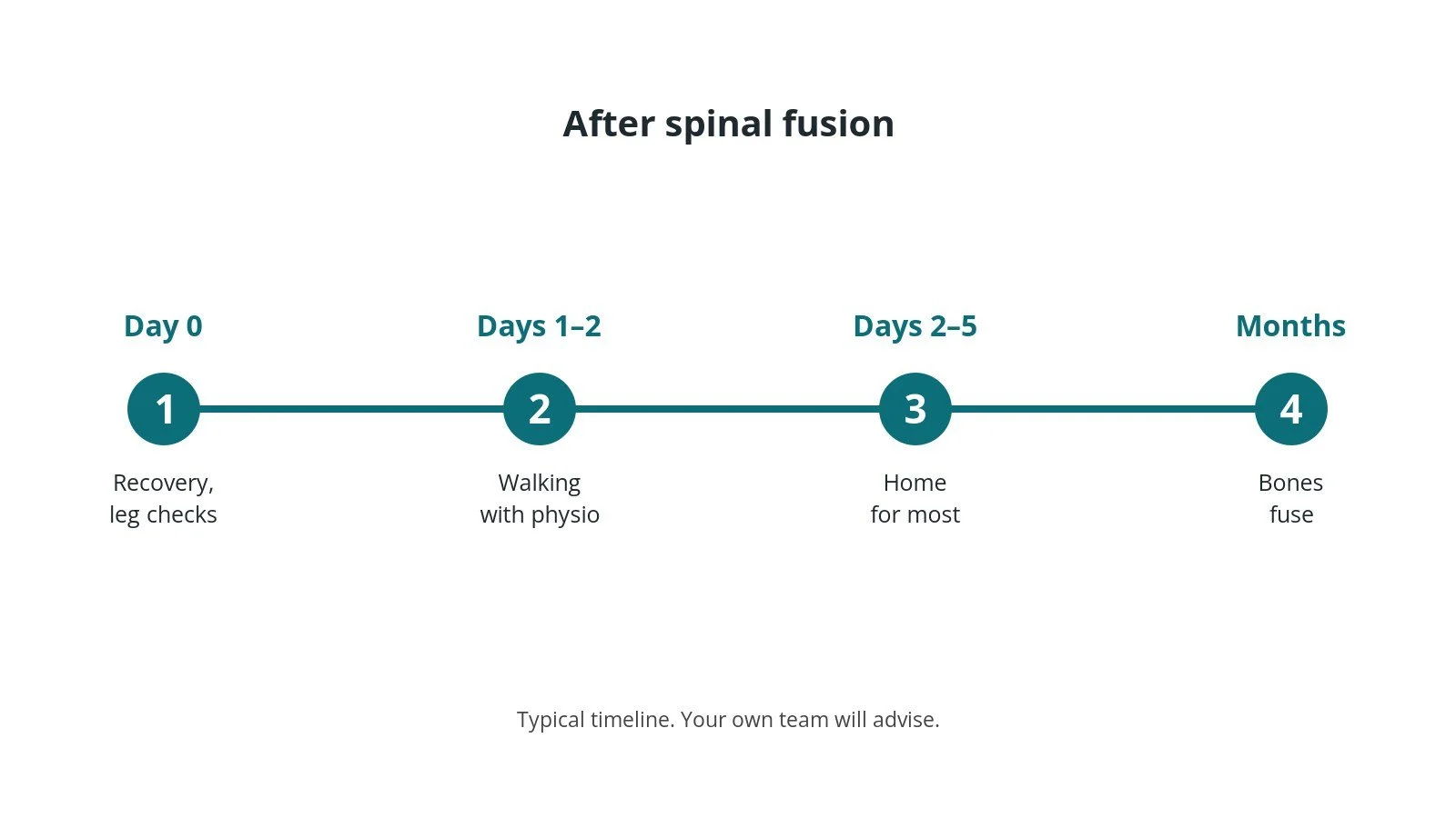 Recovery timeline after spinal fusion: Day 0: Recovery, leg checks, Days 1–2: Walking with physio, Days 2–5: Home for most, Months: Bones fuse