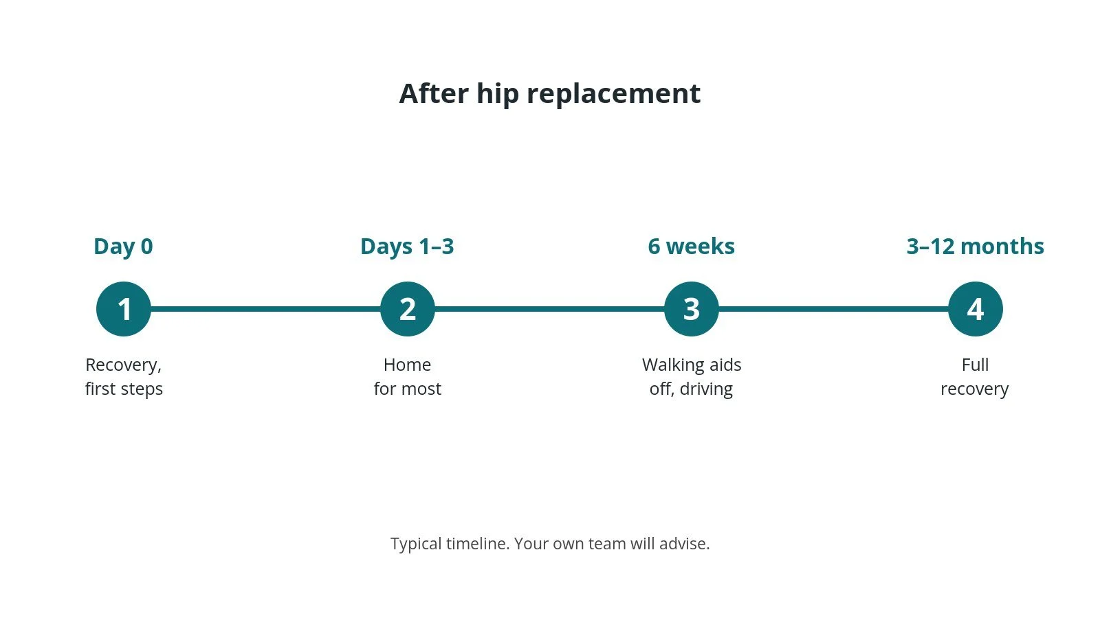 Recovery timeline after hip replacement: Day 0: Recovery, first steps, Days 1–3: Home for most, 6 weeks: Walking aids off, driving, 3–12 months: Full recovery