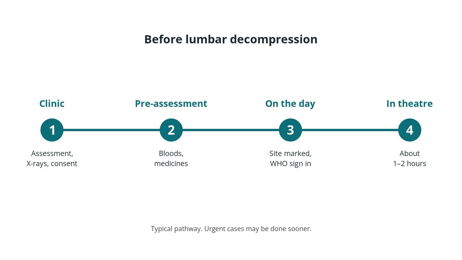 Timeline of the usual steps before lumbar decompression: Clinic: Assessment, X-rays, consent, Pre-assessment: Bloods, medicines, On the day: Site marked, WHO sign in, In theatre: About 1–2 hours