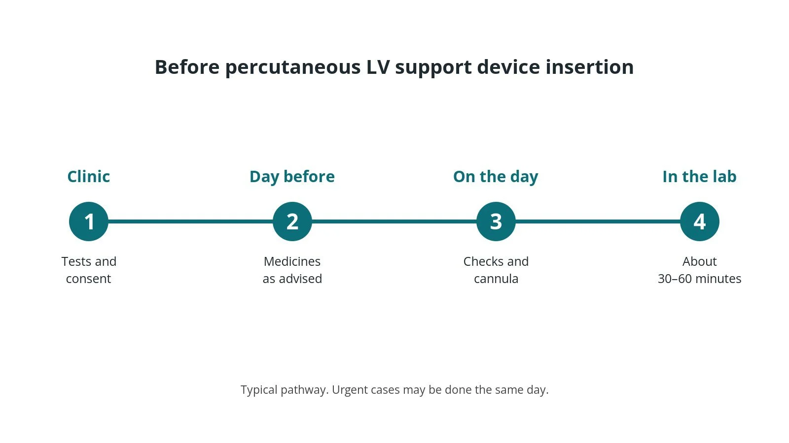 Timeline of the usual steps before percutaneous LV support device insertion: clinic tests and consent, medicine advice, checks on the day, and the procedure