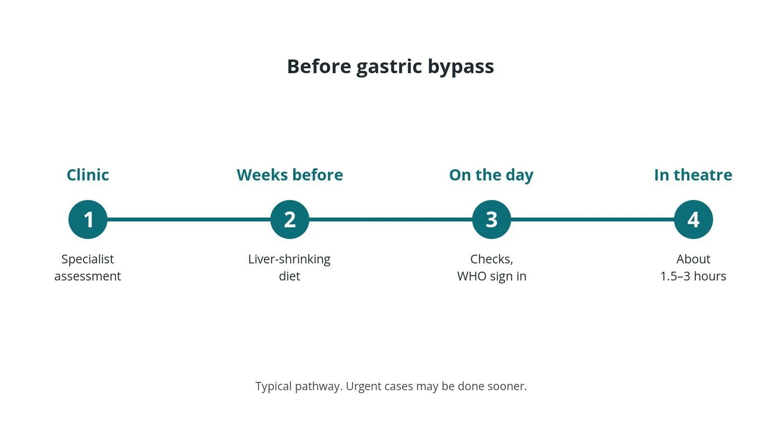Timeline of the usual steps before gastric bypass: Clinic: Specialist assessment, Weeks before: Liver-shrinking diet, On the day: Checks, WHO sign in, In theatre: About 1.5–3 hours