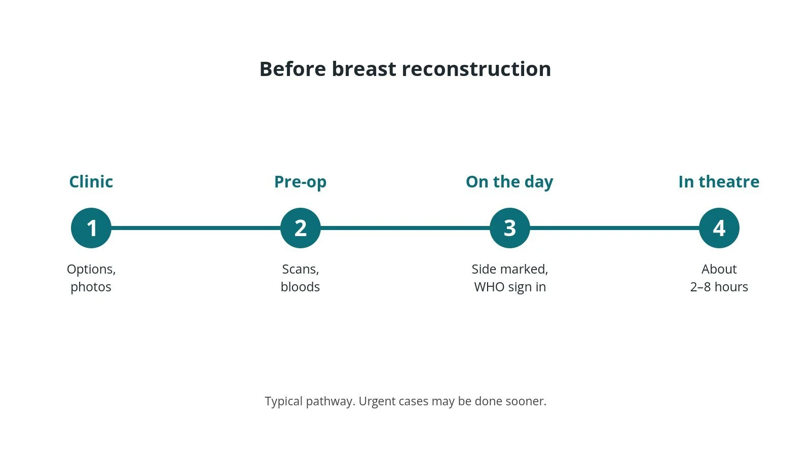 Timeline of the usual steps before breast reconstruction: Clinic: Options, photos, Pre-op: Scans, bloods, On the day: Side marked, WHO sign in, In theatre: About 2–8 hours