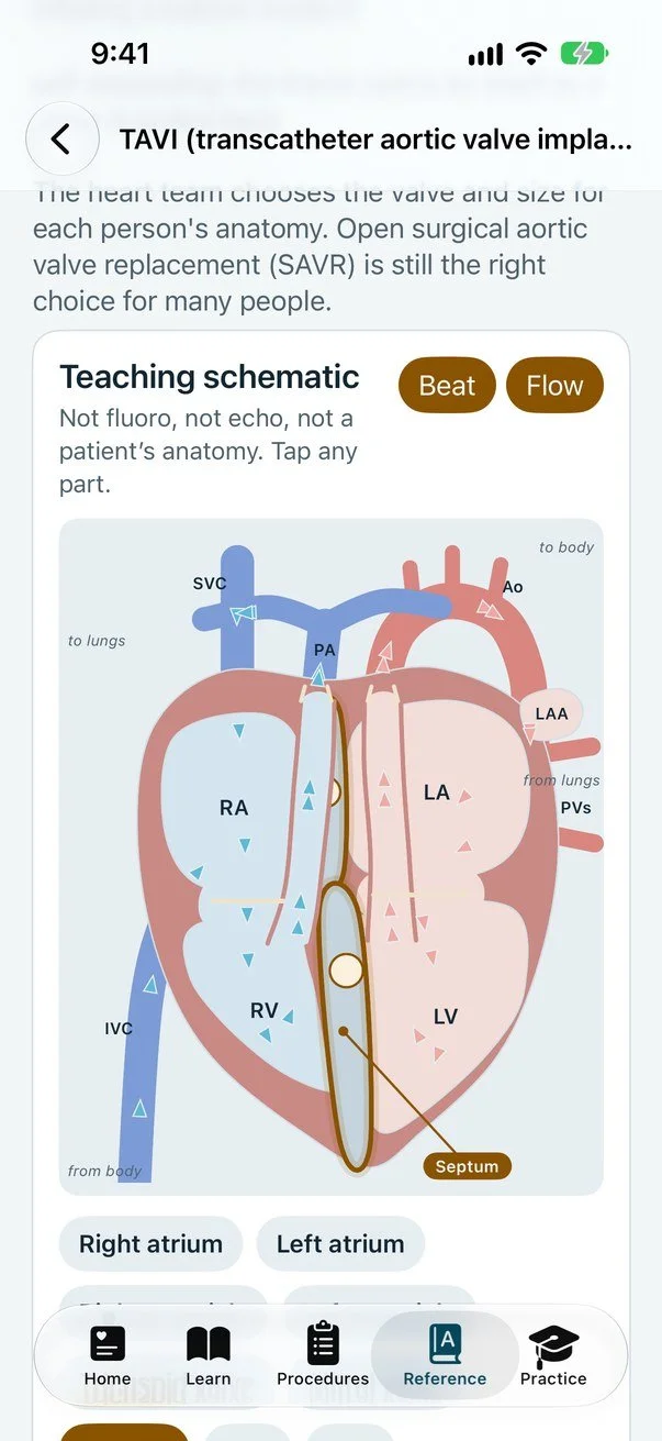 Cath Lab 101 on iPhone: the TAVI guide's teaching schematic of the heart, with chambers, valves, great vessels and flow arrows