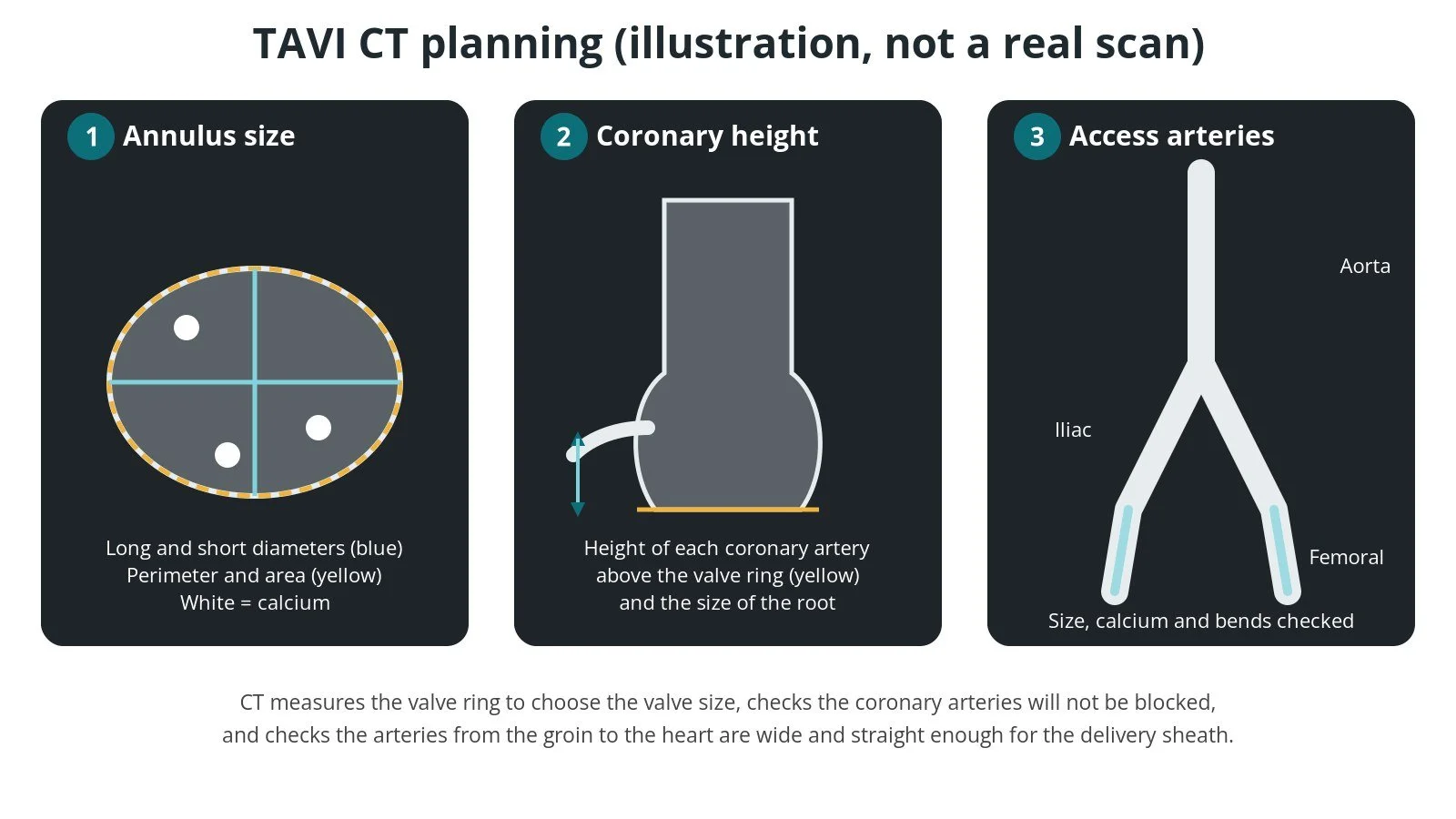 Three illustrated CT planning views: measuring the aortic valve ring, measuring the height of a coronary artery above the valve, and checking the aorta, iliac and femoral arteries