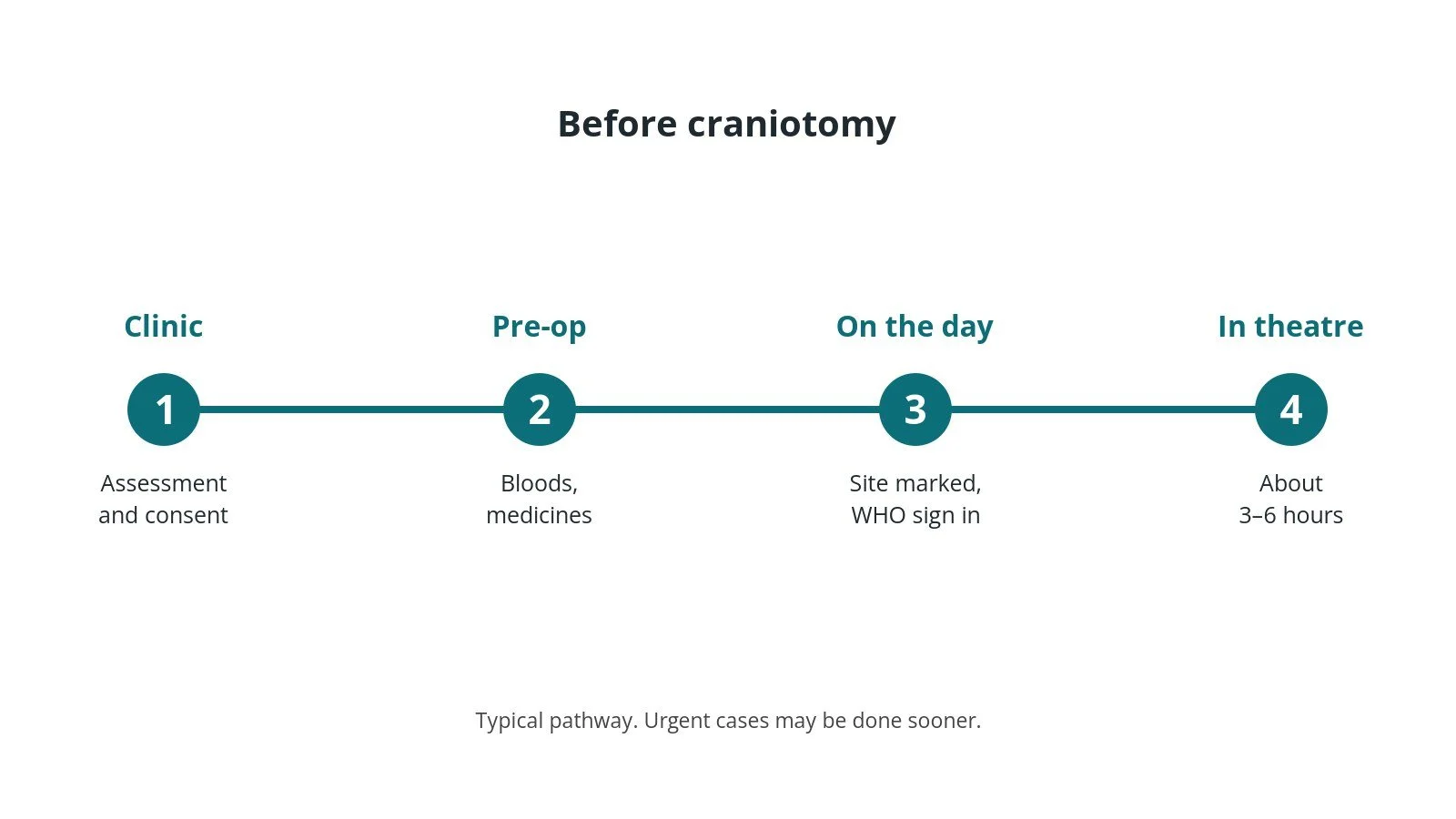 Timeline of the usual steps before craniotomy: Clinic: Assessment and consent, Pre-op: Bloods, medicines, On the day: Site marked, WHO sign in, In theatre: About 3–6 hours