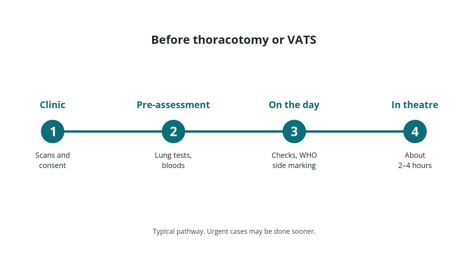 Timeline of the usual steps before thoracotomy or VATS: Clinic: Scans and consent, Pre-assessment: Lung tests, bloods, On the day: Checks, WHO side marking, In theatre: About 2–4 hours