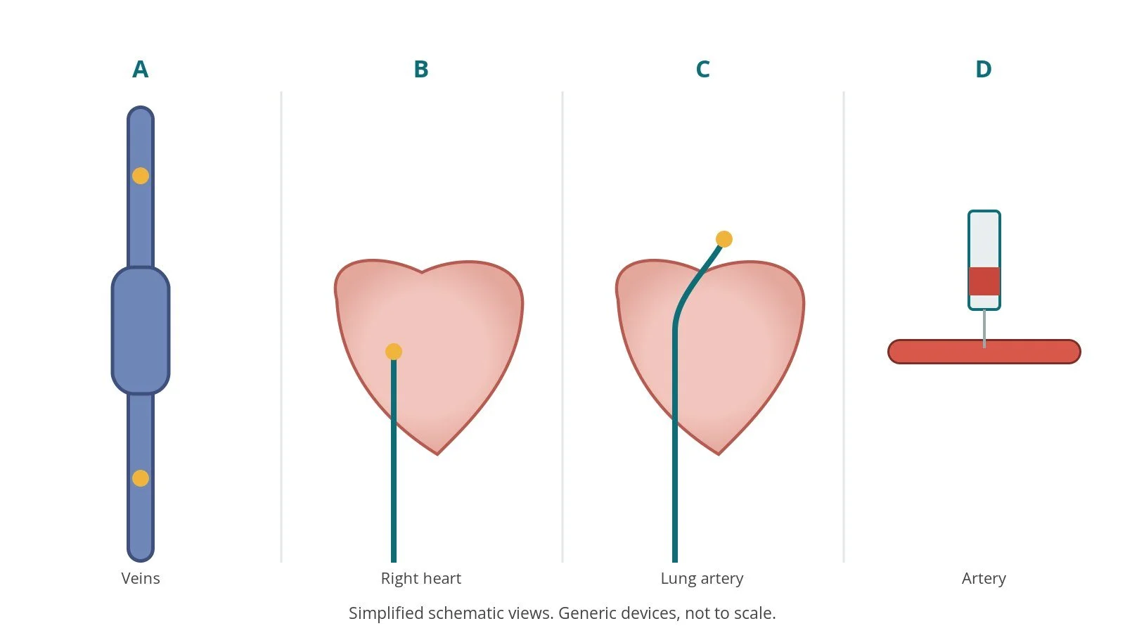 Four-panel schematic of shunt detection: veins, right heart, lung artery, artery