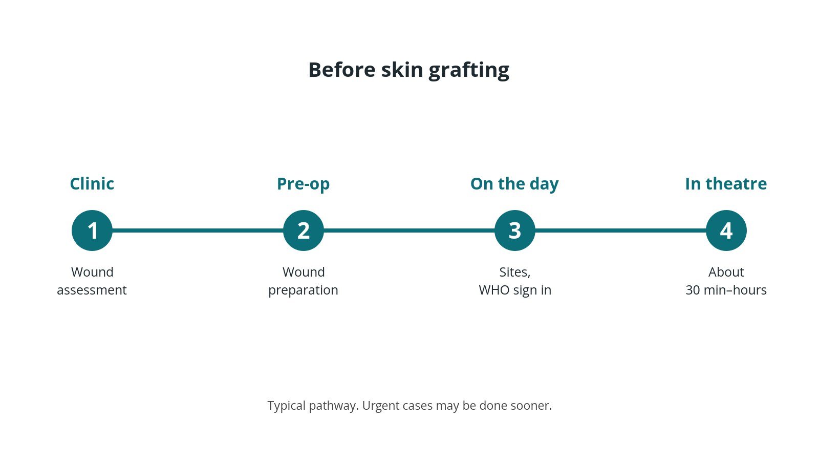 Timeline of the usual steps before skin grafting: Clinic: Wound assessment, Pre-op: Wound preparation, On the day: Sites, WHO sign in, In theatre: About 30 min–hours