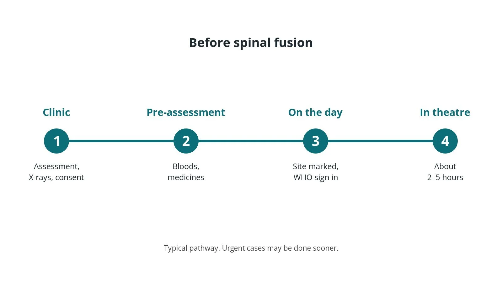 Timeline of the usual steps before spinal fusion: Clinic: Assessment, X-rays, consent, Pre-assessment: Bloods, medicines, On the day: Site marked, WHO sign in, In theatre: About 2–5 hours