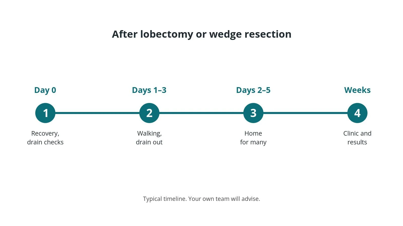 Recovery timeline after lobectomy or wedge resection: Day 0: Recovery, drain checks, Days 1–3: Walking, drain out, Days 2–5: Home for many, Weeks: Clinic and results
