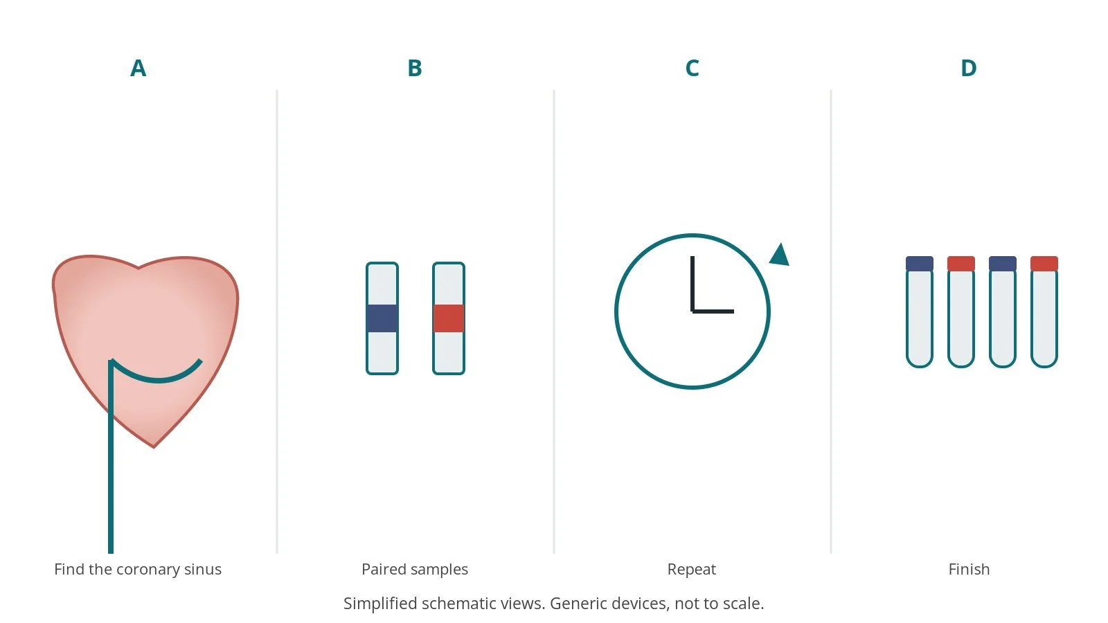 Four-panel schematic of myocardial metabolism studies: find the coronary sinus, paired samples, repeat, finish