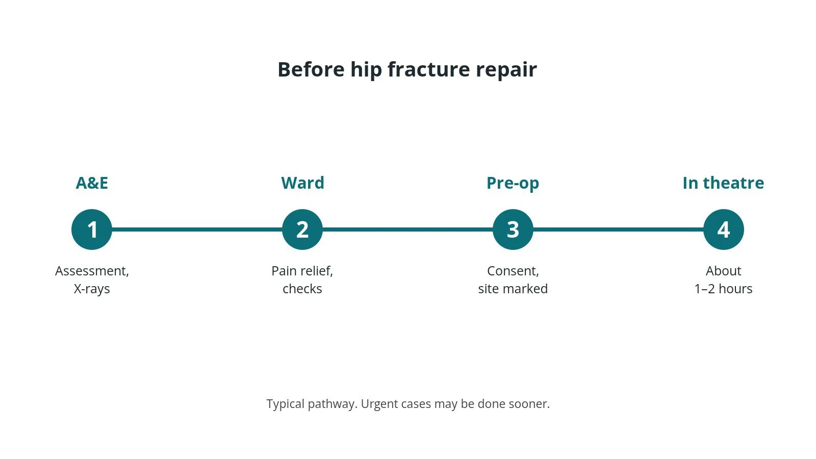 Timeline of the usual steps before hip fracture repair: A&E: Assessment, X-rays, Ward: Pain relief, checks, Pre-op: Consent, site marked, In theatre: About 1–2 hours