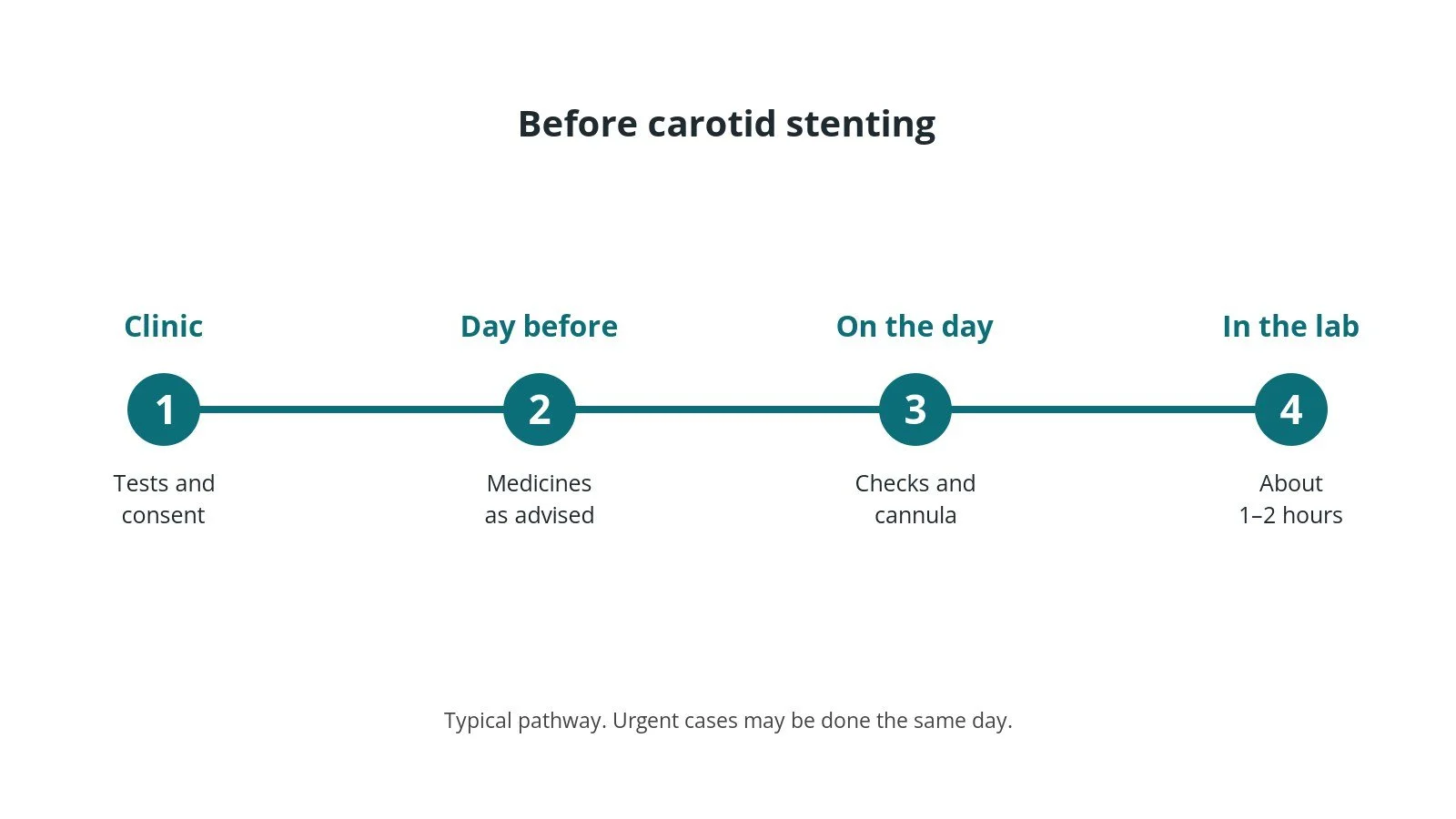 Timeline of the usual steps before carotid stenting: clinic tests and consent, medicine advice, checks on the day, and the procedure