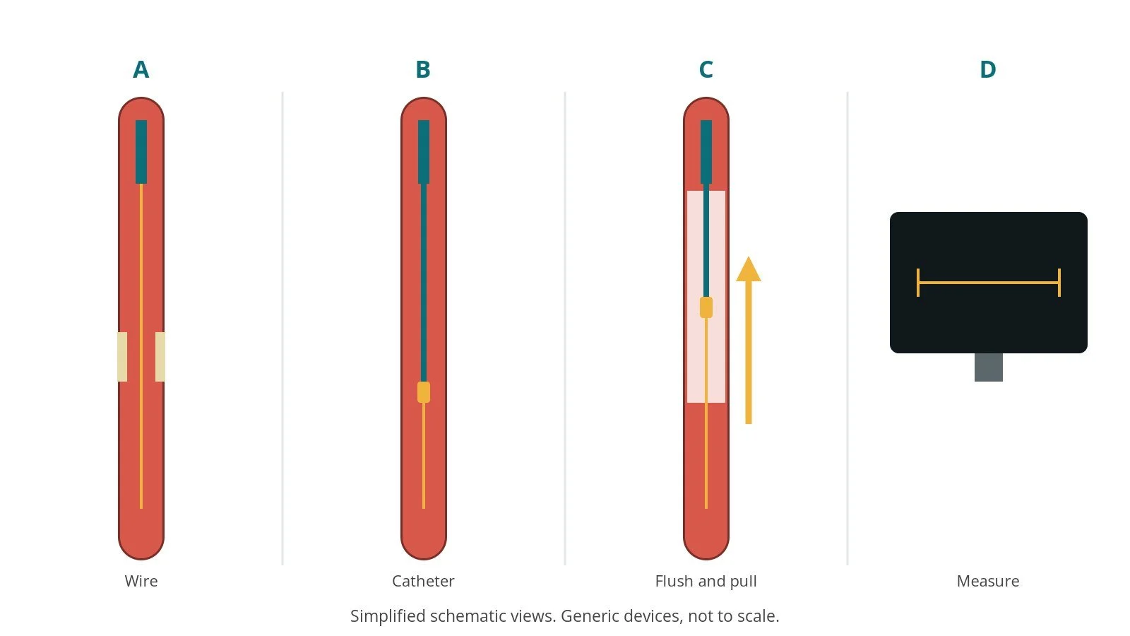 Four-panel schematic of OCT: wire, catheter, flush and pull, measure