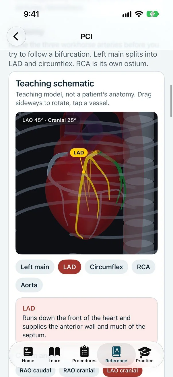 Cath Lab 101 on iPhone: the 3D coronary model at LAO 45, cranial 25 with the LAD highlighted
