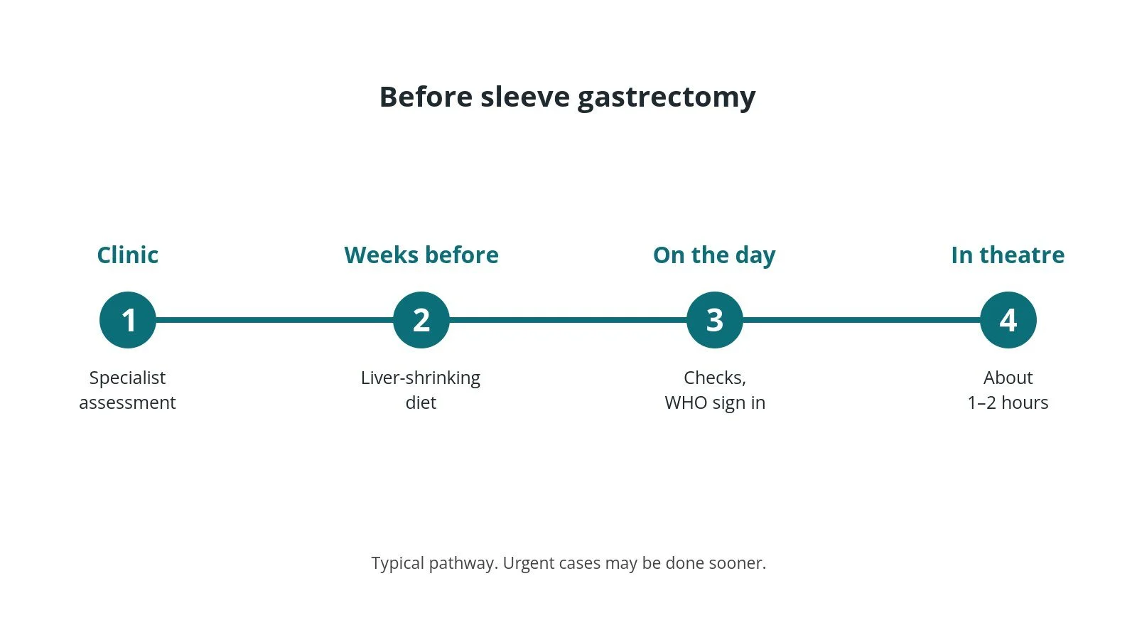 Timeline of the usual steps before sleeve gastrectomy: Clinic: Specialist assessment, Weeks before: Liver-shrinking diet, On the day: Checks, WHO sign in, In theatre: About 1–2 hours