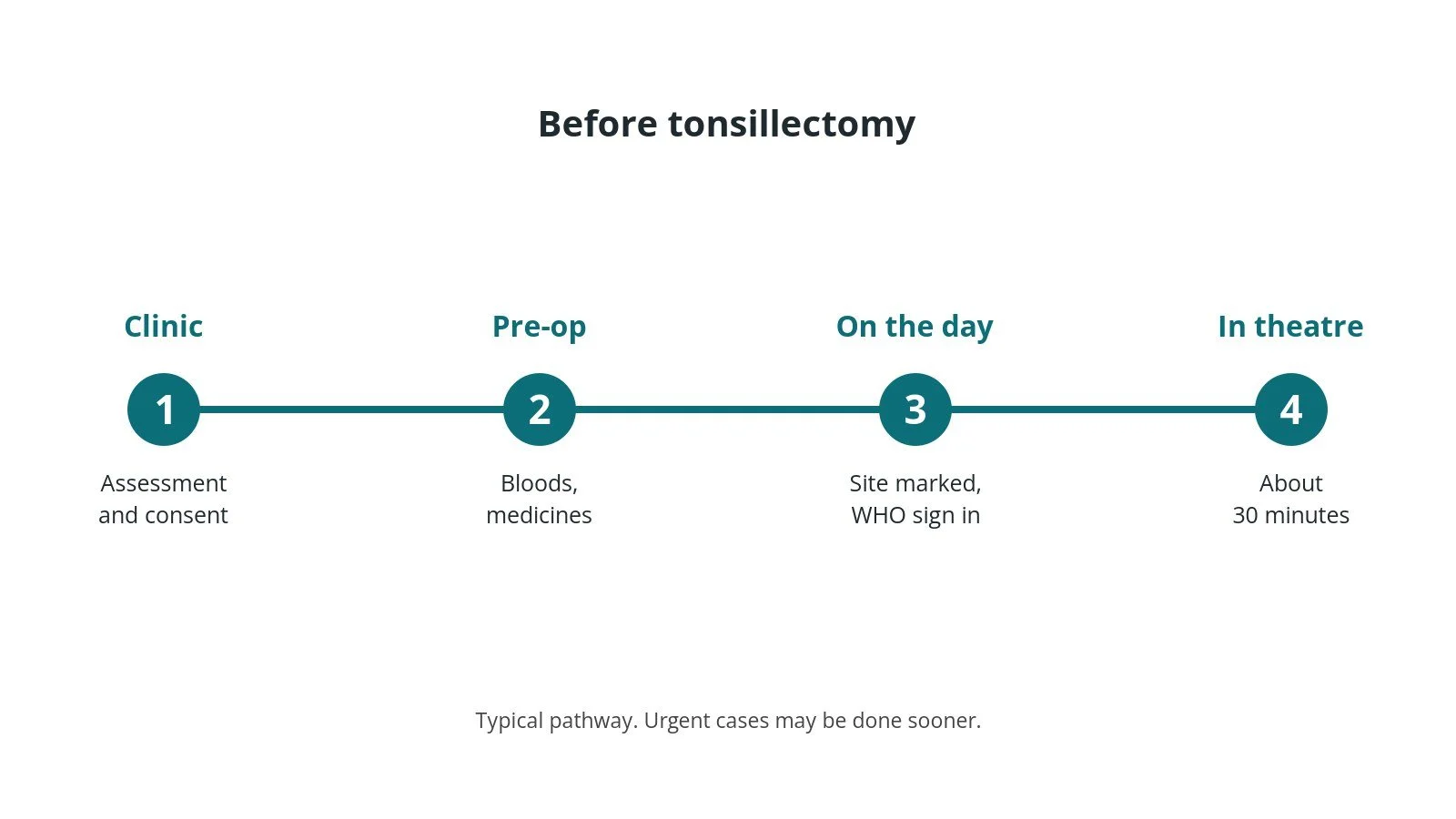 Timeline of the usual steps before tonsillectomy: Clinic: Assessment and consent, Pre-op: Bloods, medicines, On the day: Site marked, WHO sign in, In theatre: About 30 minutes