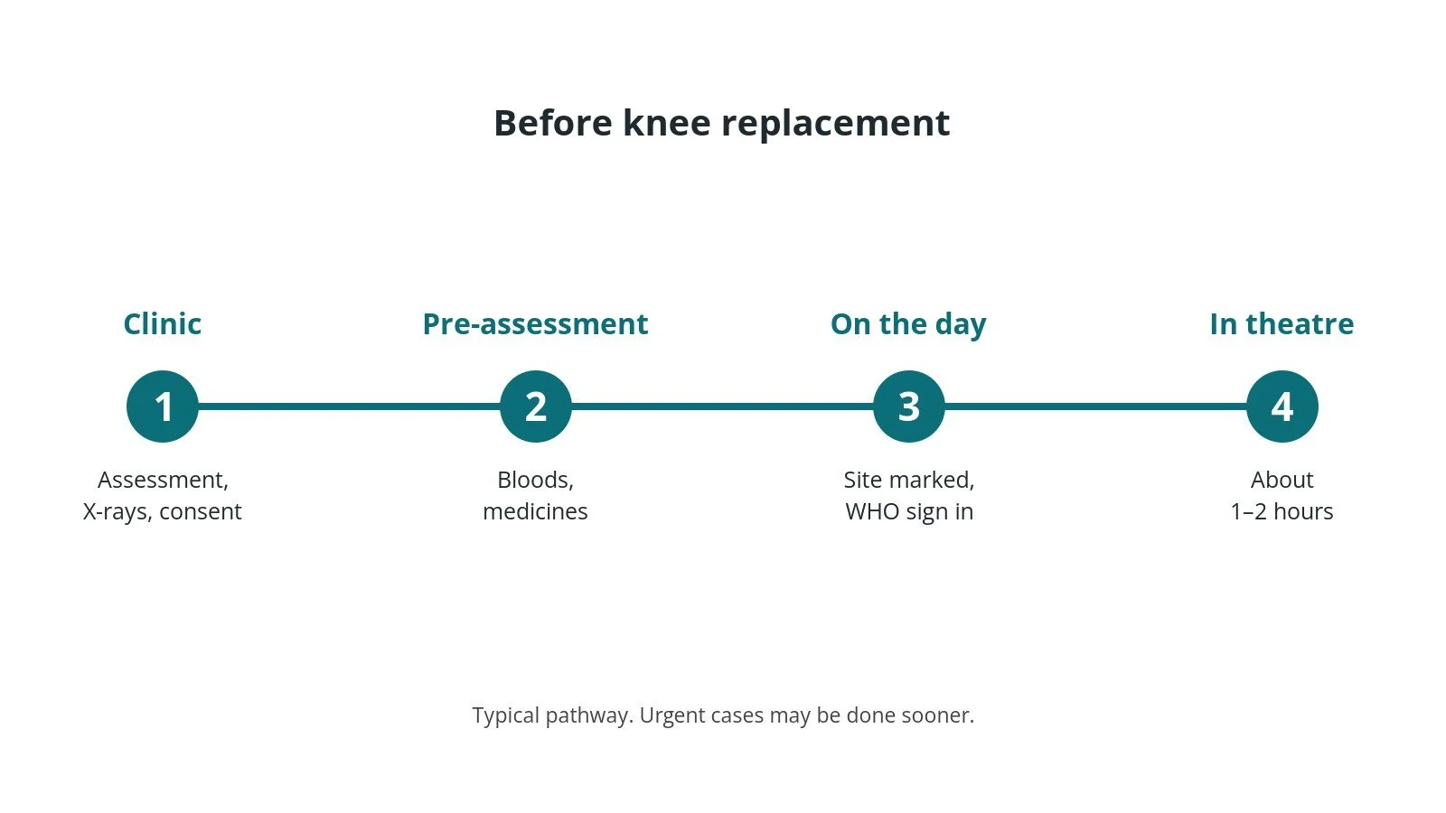 Timeline of the usual steps before knee replacement: Clinic: Assessment, X-rays, consent, Pre-assessment: Bloods, medicines, On the day: Site marked, WHO sign in, In theatre: About 1–2 hours
