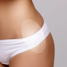 treatment-area-hips.jpg