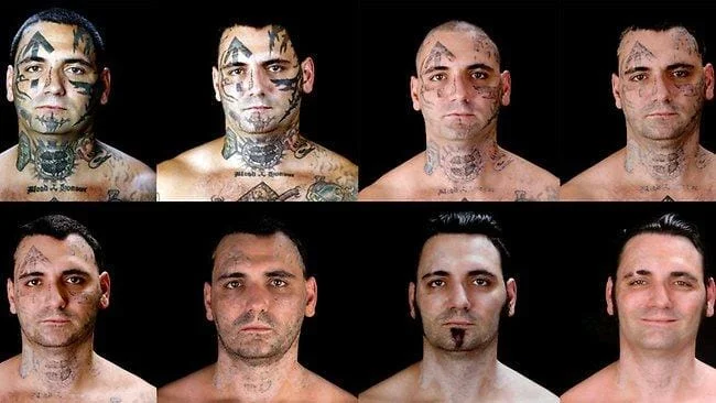 tattoo removal many images.jpeg