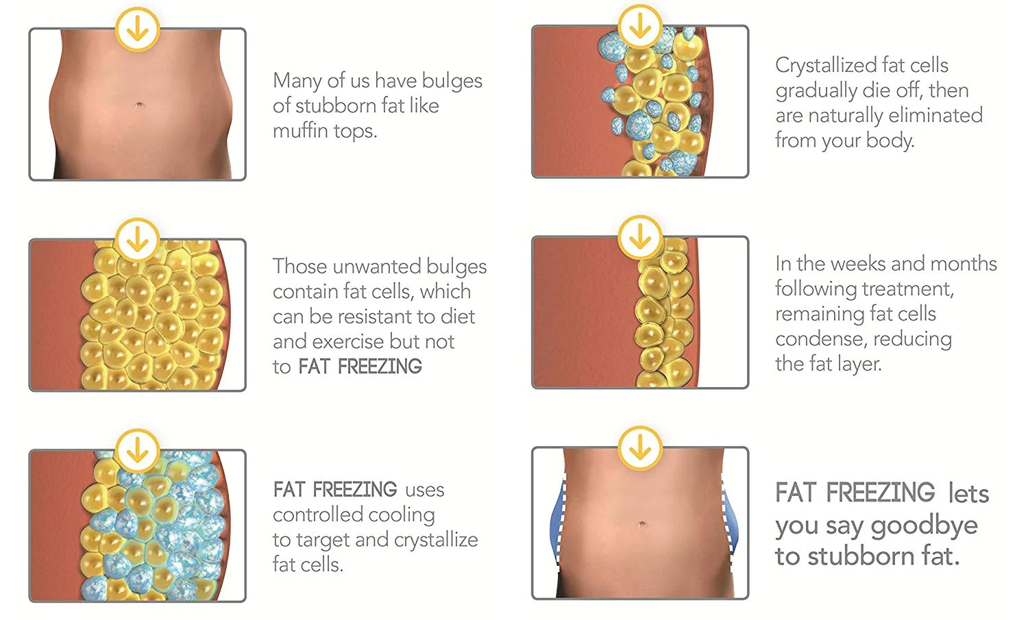 fat freezing .jpg