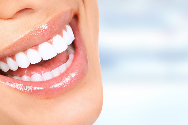 Teeth-Whitening.png