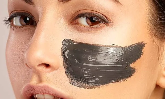 carbon laser peel.jpg