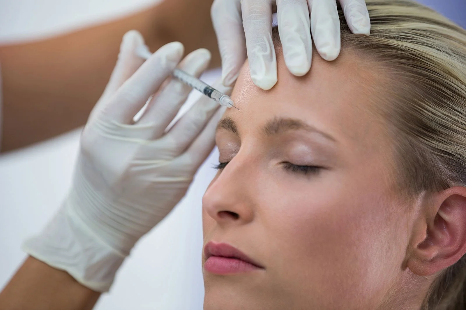 How Long Do Facial Fillers Last? Your Complete Guide