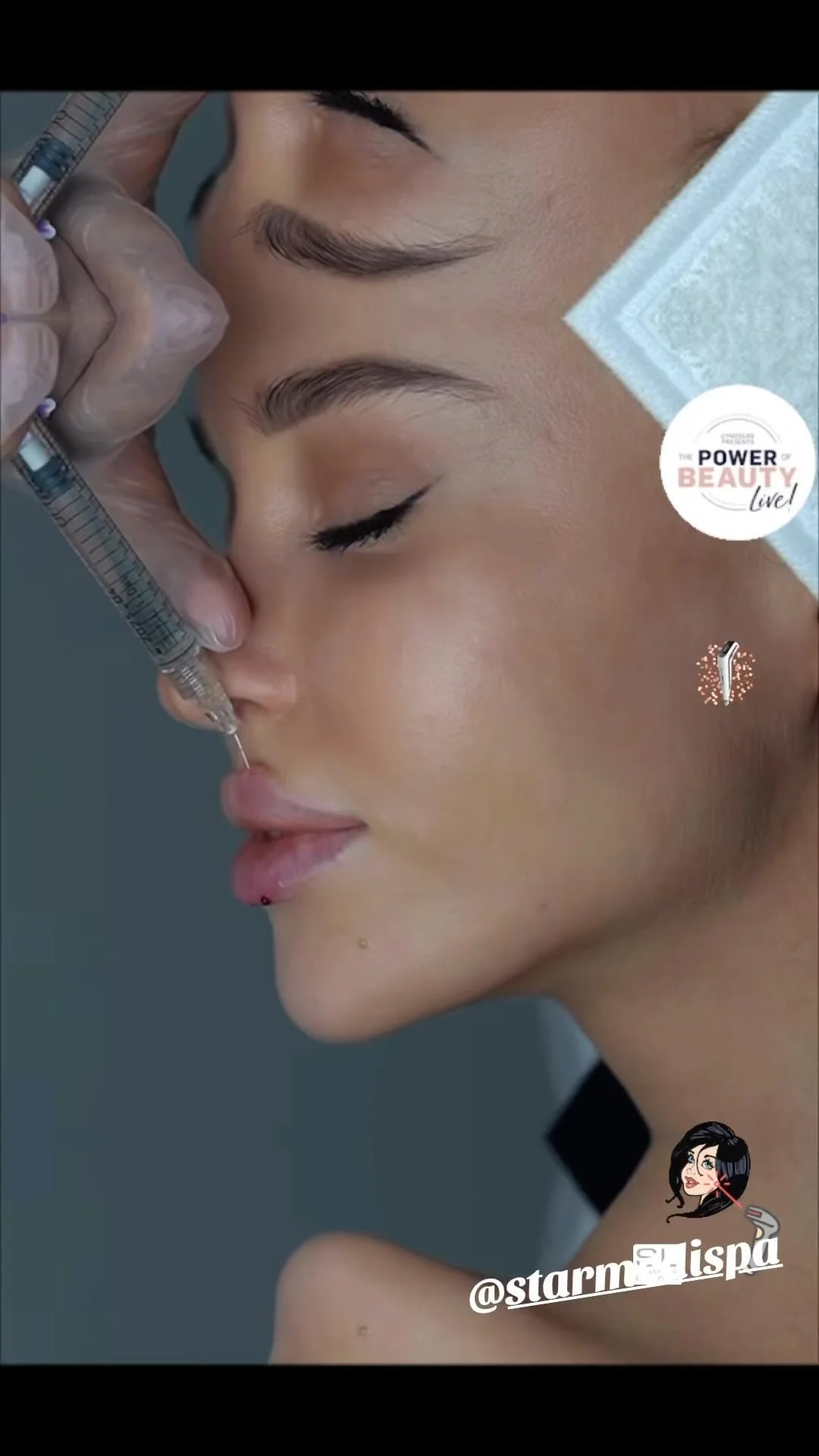 Full Lip Filler in Sydney Your Guide to Plumper Lips Star Medispa