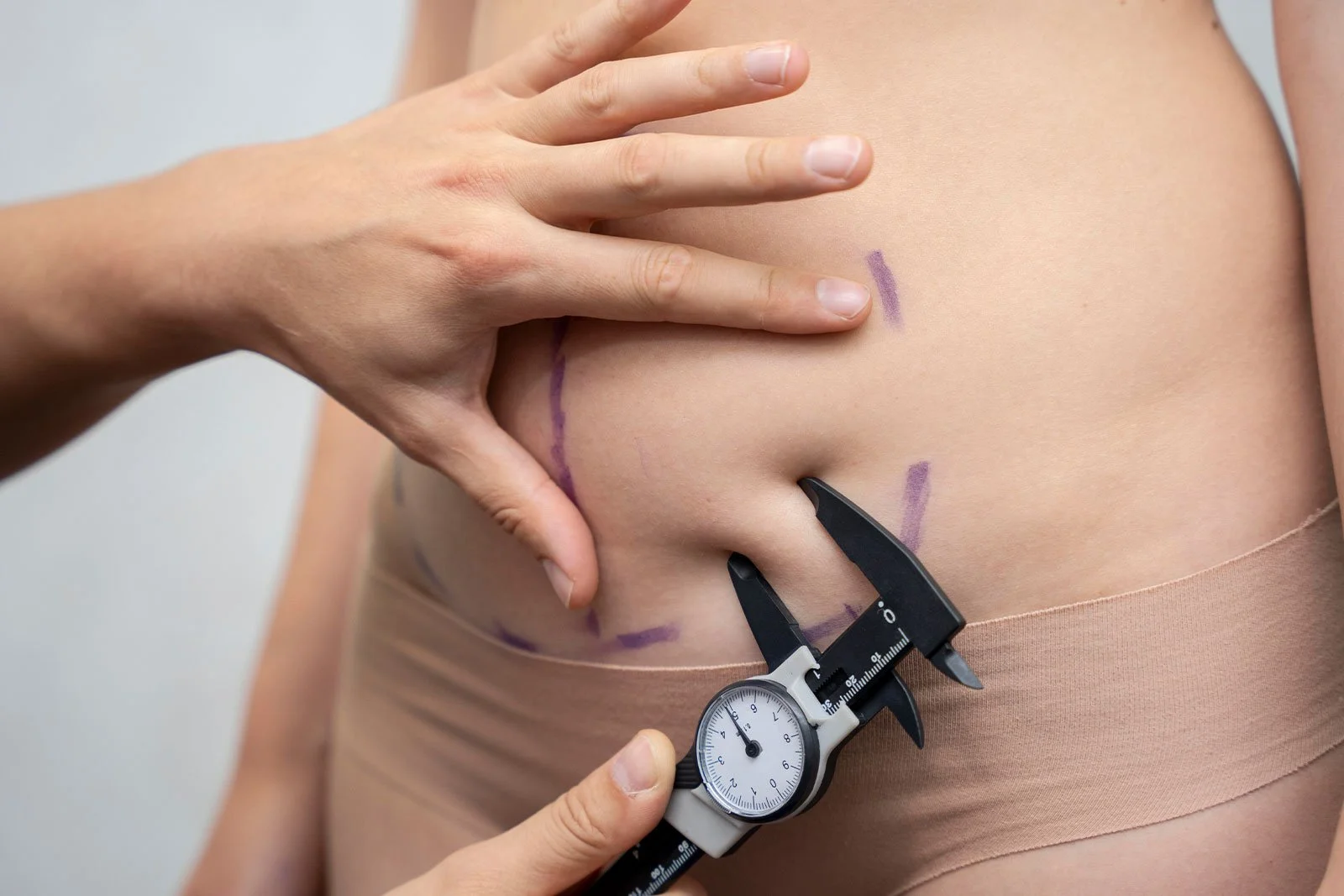 Do Fat Freezing Treatments Work? An In-Depth Look