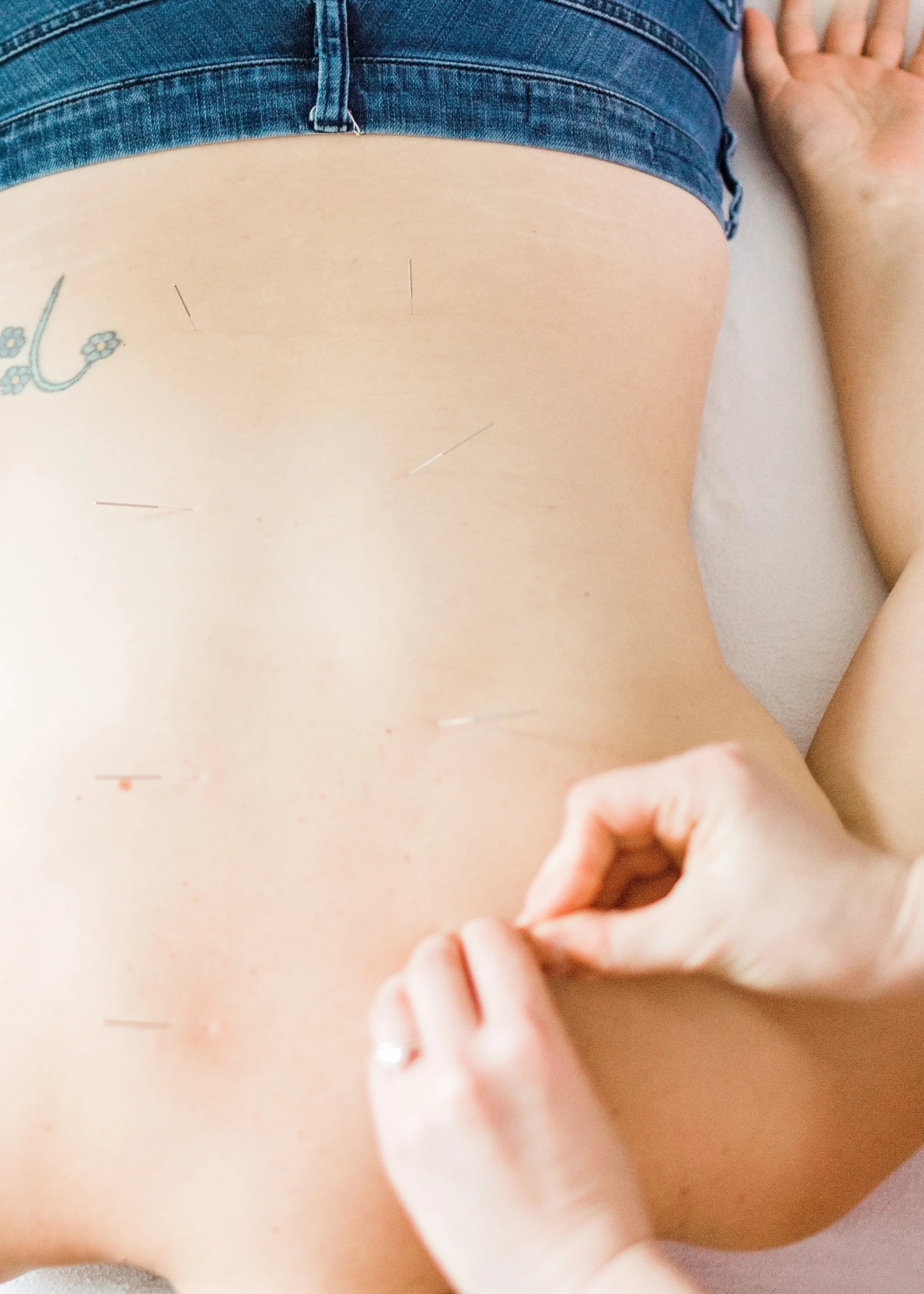 Dry needling in Portland targets the trigger points of specific muscles that results in greater range of motion, reduced pain and better performance.