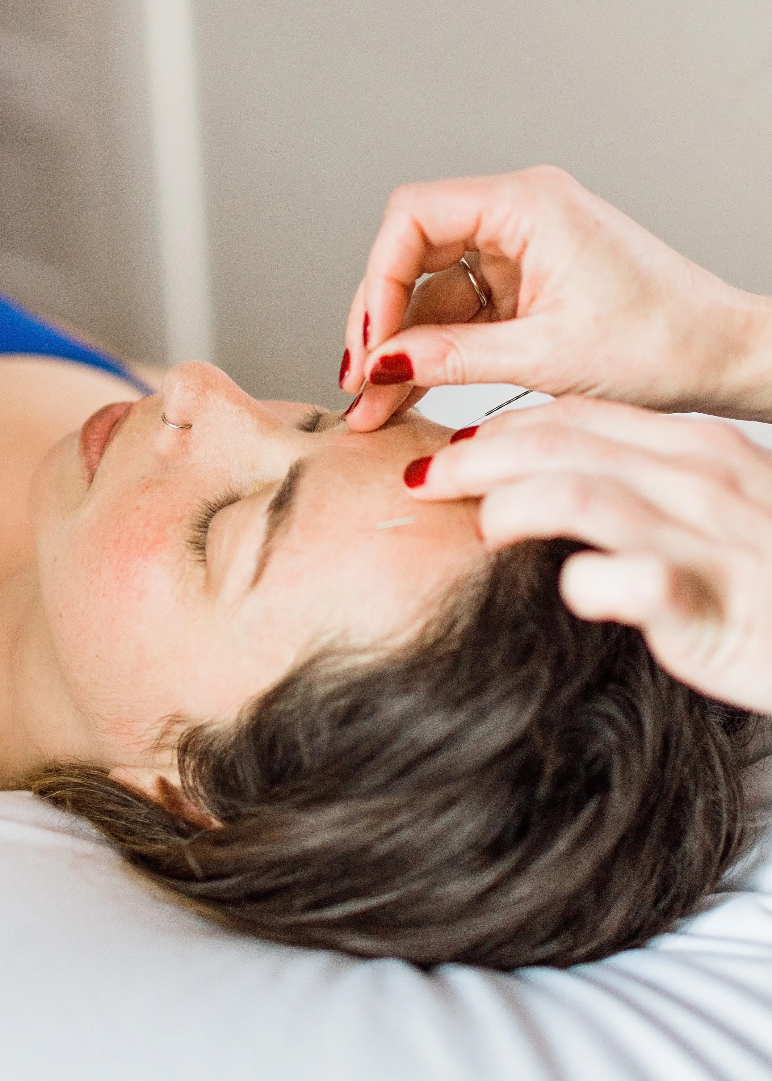 Dry needling and acupuncture are different systems of medicine. At To The Point PDX, we practice dry needling, also known as trigger point therapy in addition to acupuncture.