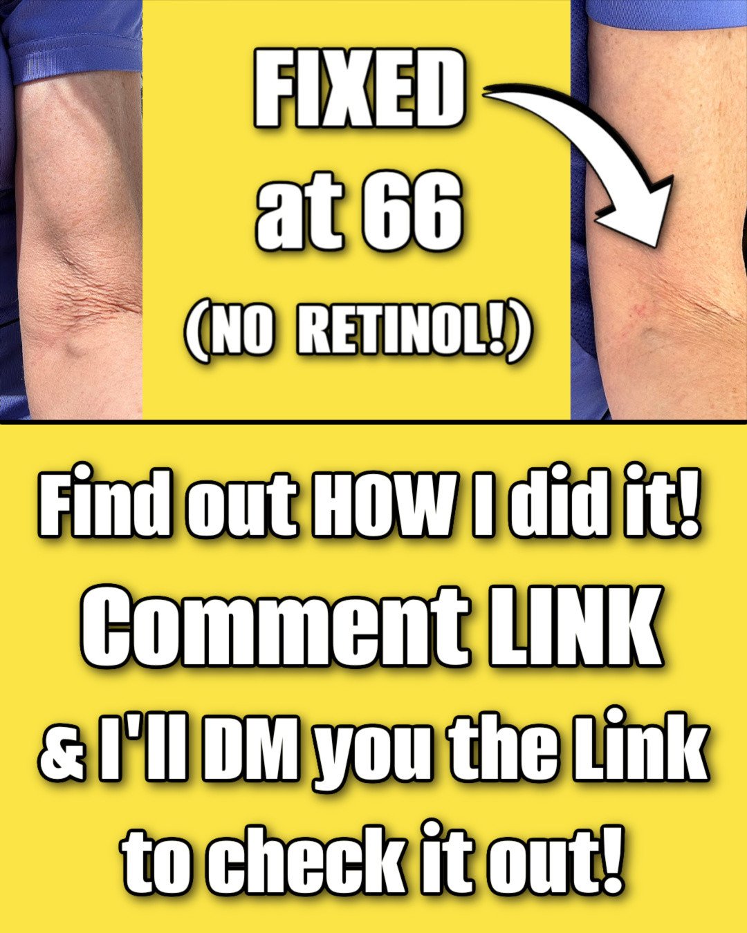 Last year, when I was 65, I suddenly noticed this... and no, I didn't use any Retinol to fix it! 🙅&zwj;♀️✨⁠
⁠
I was in the middle of a workout and noticed the skin on my inner arms was starting to look like crepe paper. It&rsquo;s a common frustrati