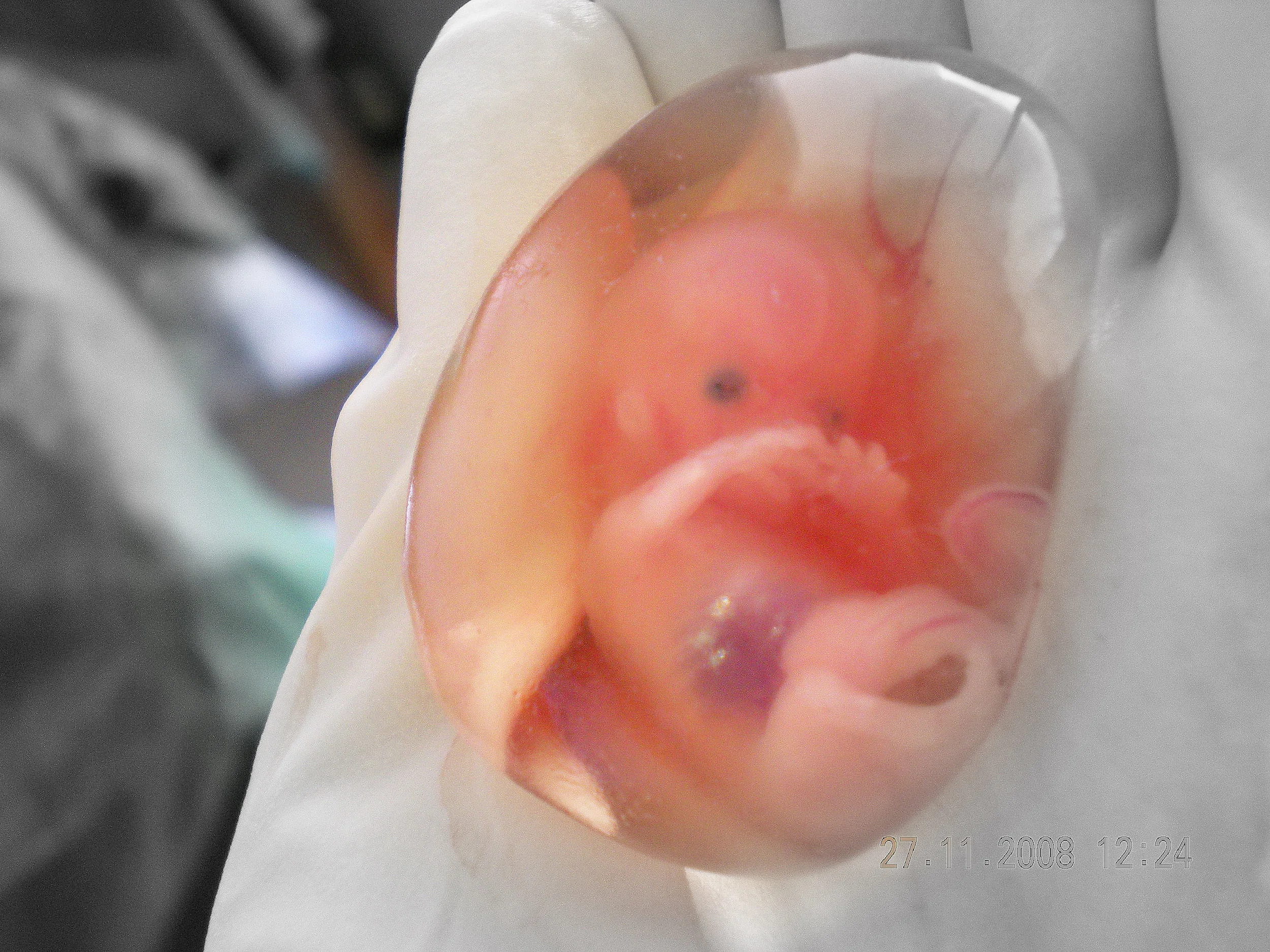 An embryo at 10 weeks gestation (8 weeks after fertilization). (Photo Credit: Suparna Sinha .)