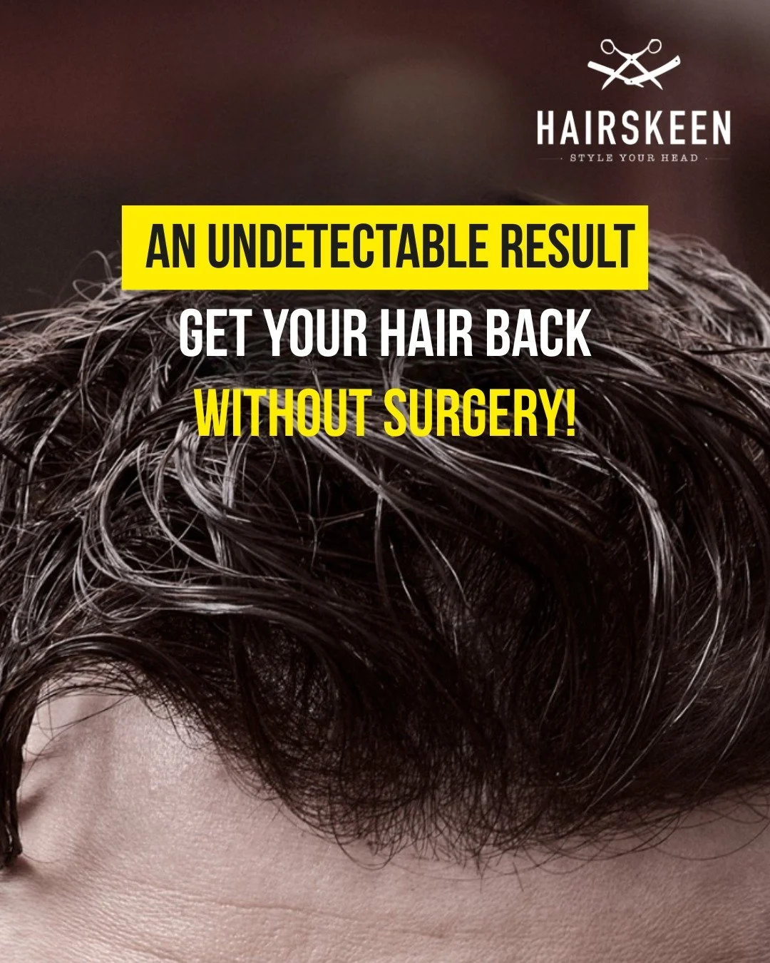 Looking for a hair solution that’s discreet, comfortable, and completely natural? ✨
Hairskeen hair systems are designed to be undetectable – even up close.
Crafted in Europe with premium materials, our systems move with you and adapt per