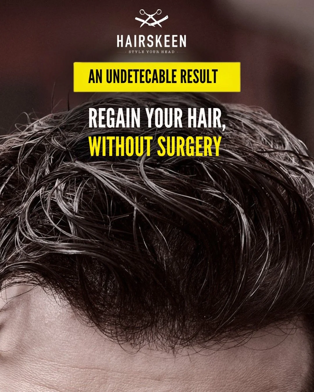 Looking for a hair solution that combines discretion, comfort, and true-to-life results?
Hairskeen hair systems are designed with premium European materials for an undetectable, natural look — even up close. Each piece is crafted to move with y