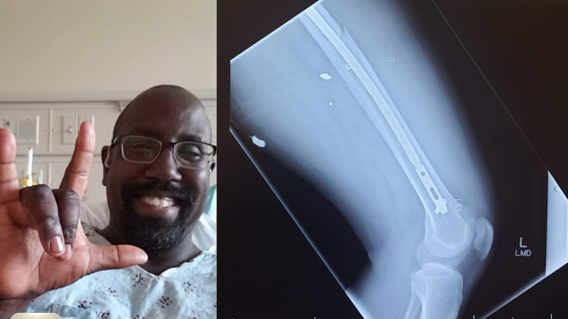 Interview with Reggie Bryant, deaf man who was randomly shot on highway