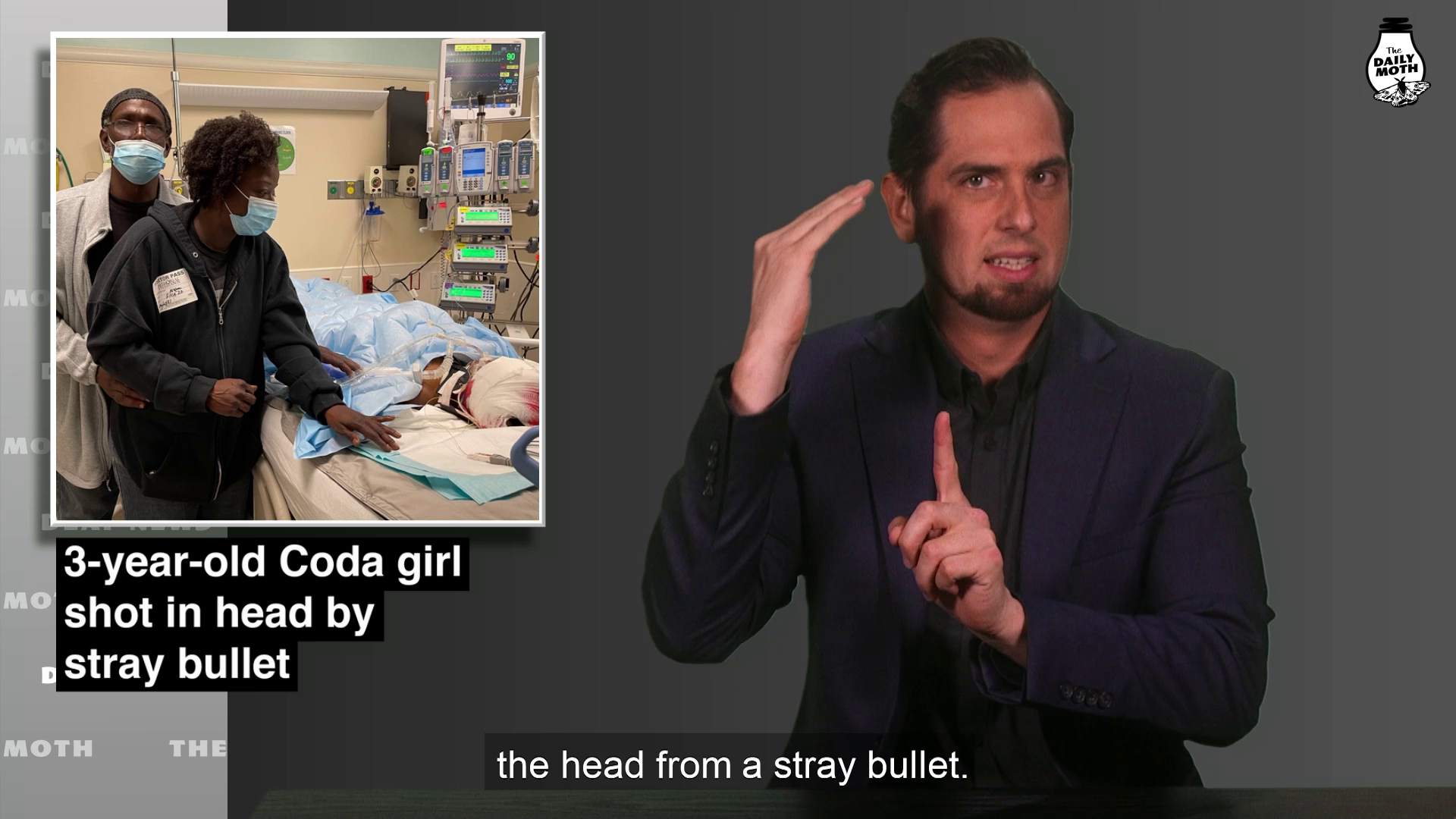 3-year-old Coda girl shot in head by stray bullet
