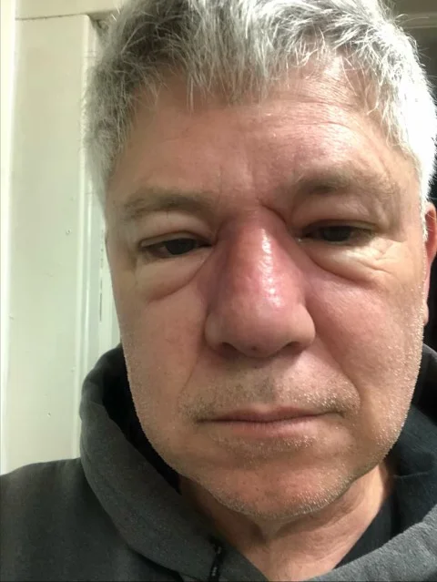 It Started With A Tickle