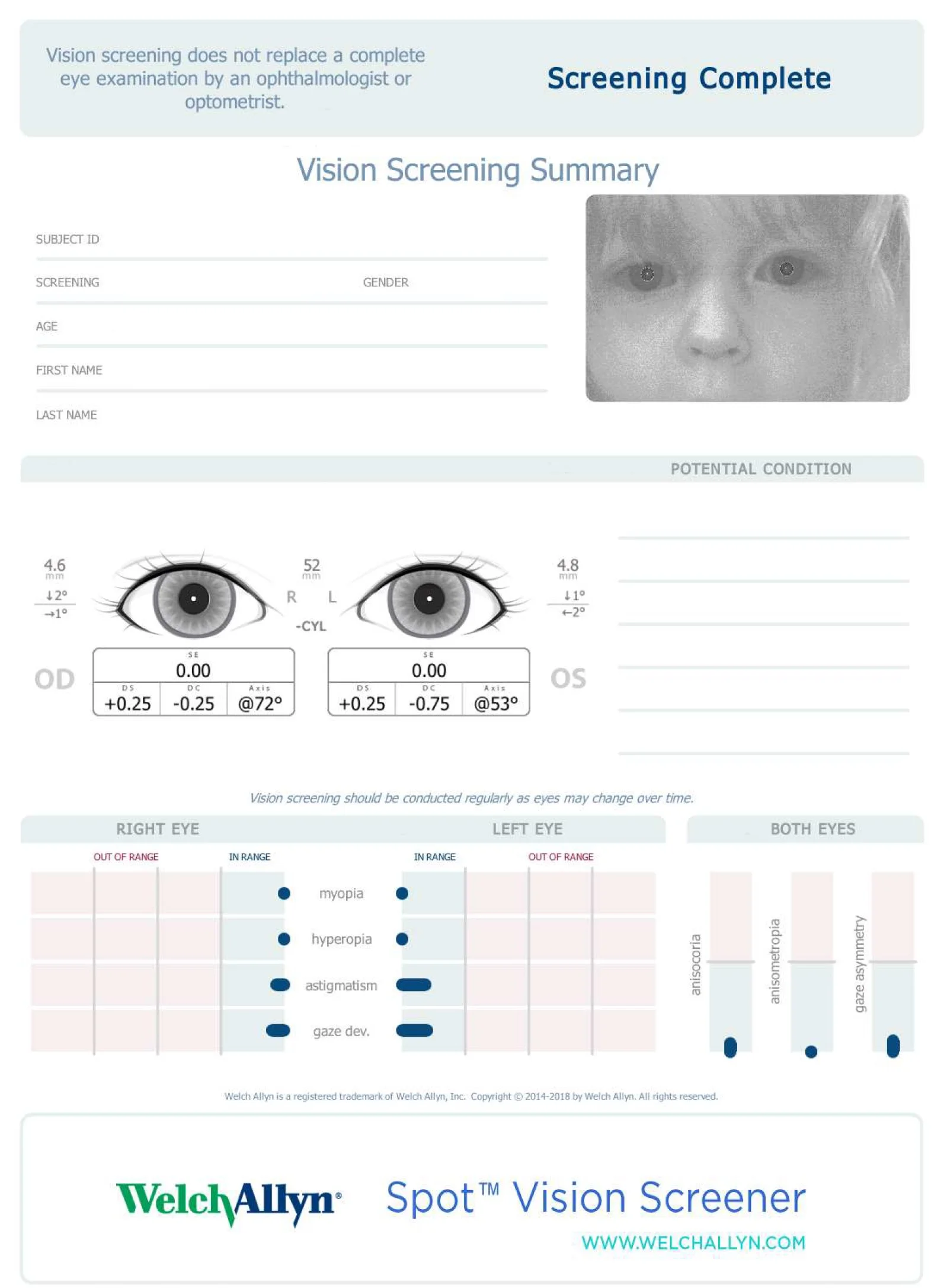 Welch-Allyn-spot-screener-kid-vision-report.jpg