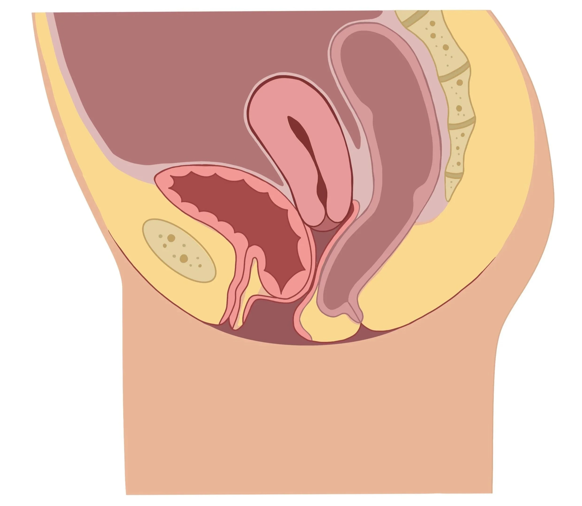 Anterior Vaginal Wall Prolapse