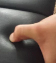 Correct (Figure 5- left) and incorrect (Figure 6 - above) thumb position when maintaining pincher grip.
