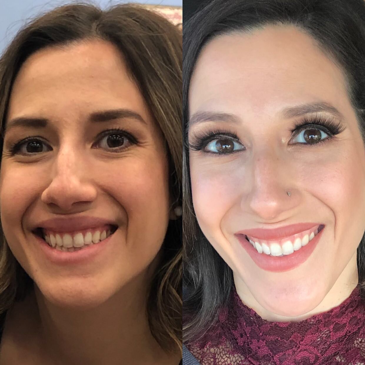Before The Skin &amp; Beauty Co. and After 👏🏼👏🏼👏🏼👏🏼👏🏼👏🏼👏🏼👏🏼👏🏼👏🏼👏🏼👏🏼👏🏼
She not only stuck to her regimen she completely changed everything! 
 Clean eating, water intake, overall taking care of herself and she GLOWS ✨
 This is