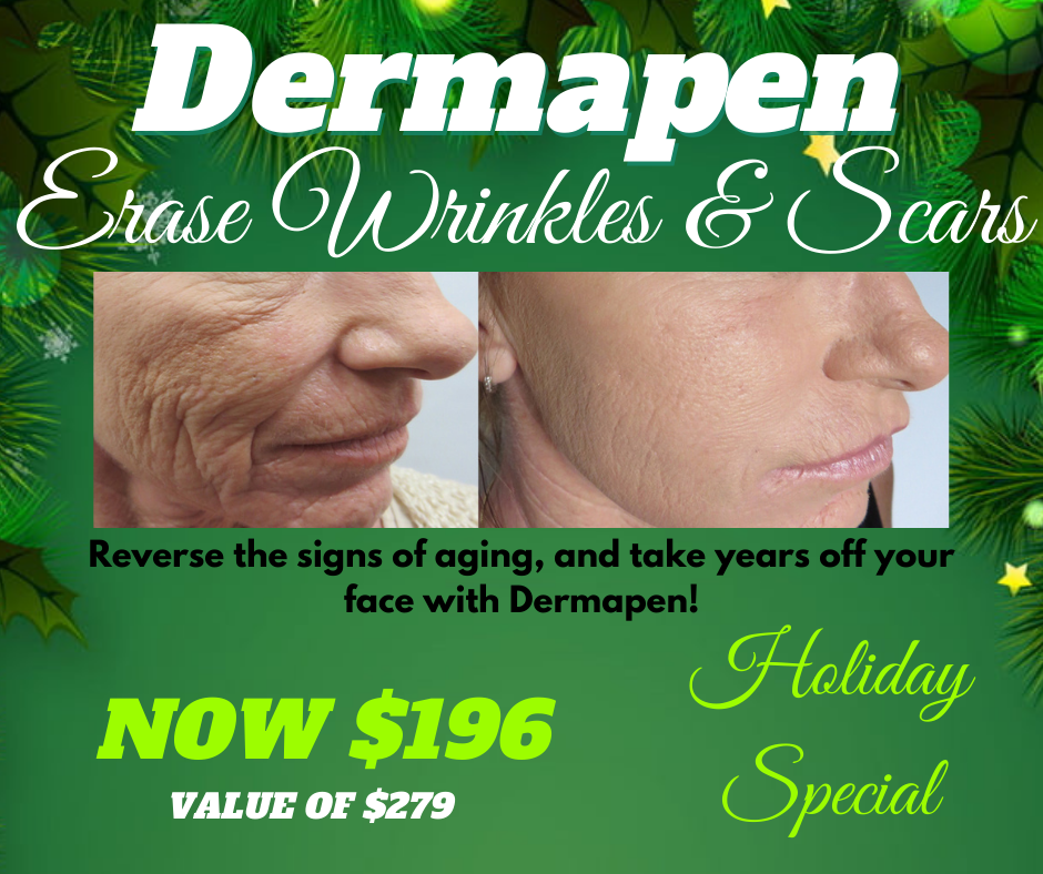 Dermapen Holiday Special